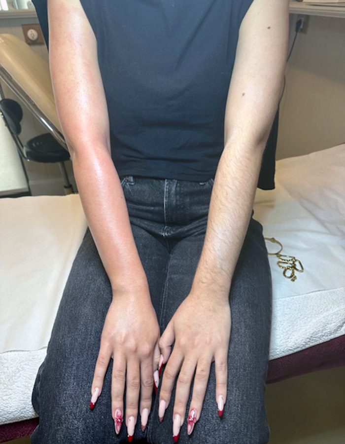 Αποτρίχωση Με Κερί Μαρία Βούλγαρη Πάτρα