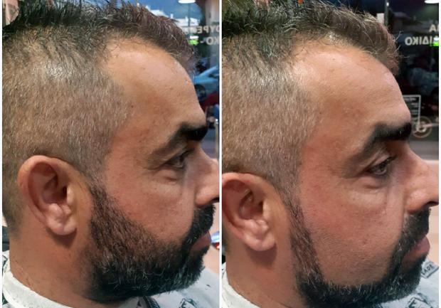 Hair Shop Only For Men | Κουρείο στην Πάτρα | Ξύρισμα