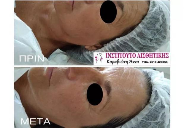 Καραβιώτη Άννα, Αισθητικός στην Πάτρα, Περιποίηση Προσώπου