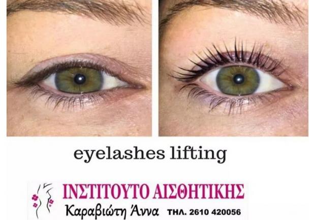 Καραβιώτη Άννα, Αισθητικός στην Πάτρα, Lifting Βλεφαρίδων
