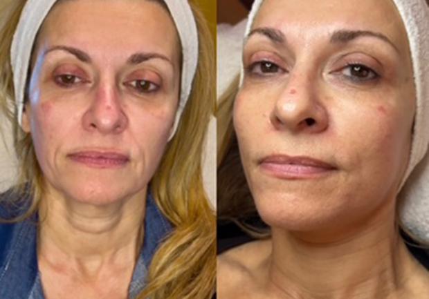 Βούλγαρη Μαρία - Διπλωματούχος ΑΤΕΙ Αισθητικής Πάτρα 13